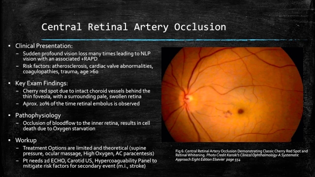 The Window to Your World: Exploring the Wonders of Ophthalmology