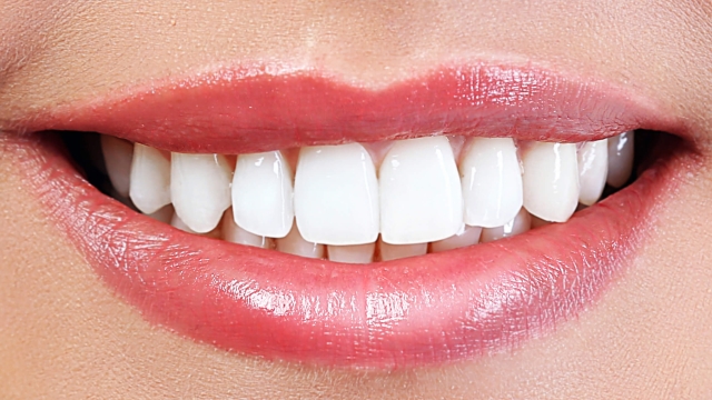 10 Secrets to a Stunning Smile with Crest Whitening Strips