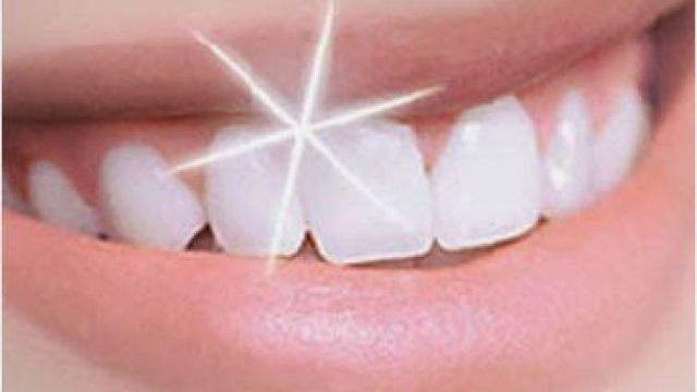Radiant Smiles: Unlock Your Teeth Whitening Secrets