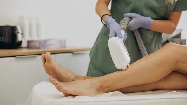 Smooth Solutions: Unveiling the Secrets of Laser Hair Removal